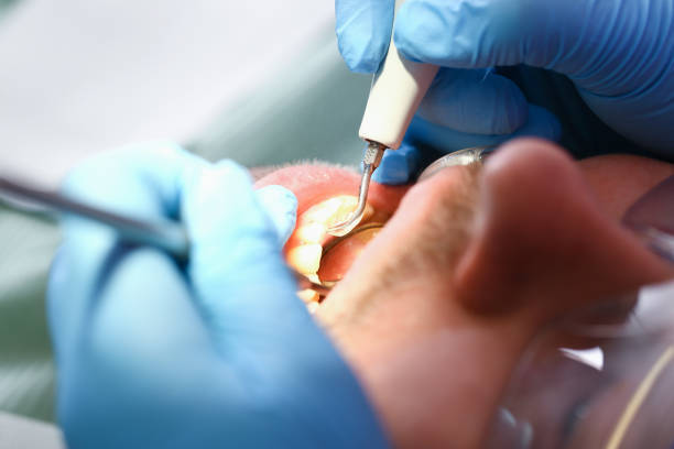 Best Broken or Cracked Tooth Emergency Dentist in Harriman, NY