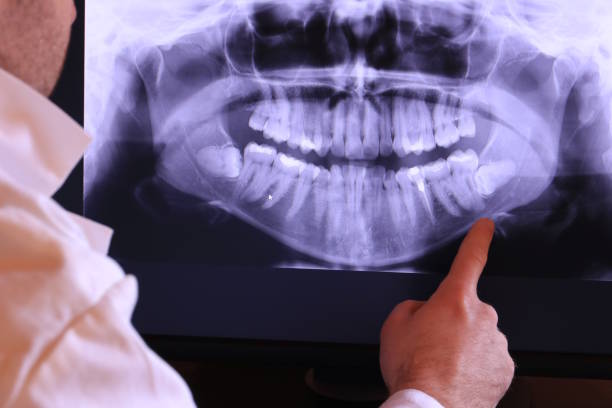 Best Holiday Emergency Dentist in Harriman, NY