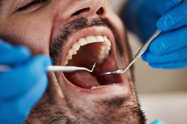 Best Emergency Dental Services for Seniors in Harriman, NY